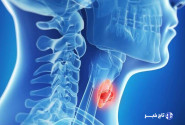 عوارض کم کاری تیروئید را بشناسید