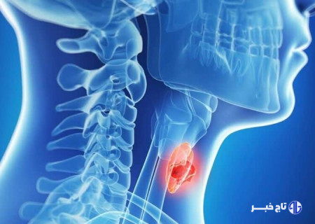 عوارض کم کاری تیروئید را بشناسید