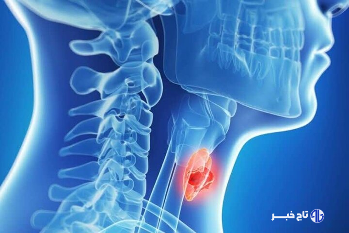 عوارض کم کاری تیروئید را بشناسید