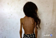 «بدون شرح»؛ کاریکاتور تلخ نشریه ایتالیایی در واکنش به گرسنگان غزه+ عکس
