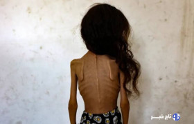 «بدون شرح»؛ کاریکاتور تلخ نشریه ایتالیایی در واکنش به گرسنگان غزه+ عکس