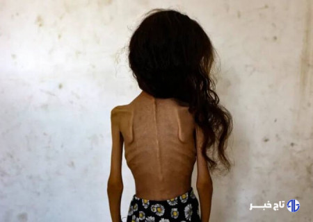 «بدون شرح»؛ کاریکاتور تلخ نشریه ایتالیایی در واکنش به گرسنگان غزه+ عکس