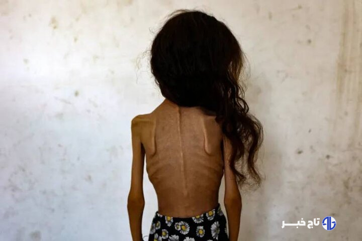 «بدون شرح»؛ کاریکاتور تلخ نشریه ایتالیایی در واکنش به گرسنگان غزه+ عکس