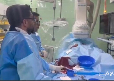 عمل موفقیت‌آمیز آنژیوپلاستی شریان مثانه در خرم‌آباد انجام شد