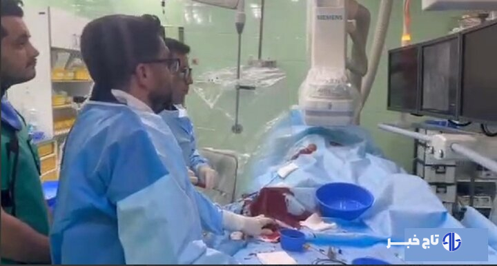 عمل موفقیت‌آمیز آنژیوپلاستی شریان مثانه در خرم‌آباد انجام شد