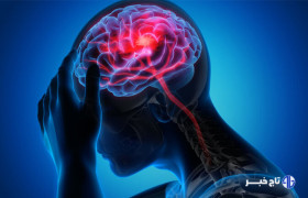 مراجعه سریع به بیمارستان کلید درمان مؤثر سکته مغزی است