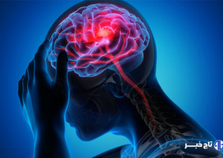 مراجعه سریع به بیمارستان کلید درمان مؤثر سکته مغزی است