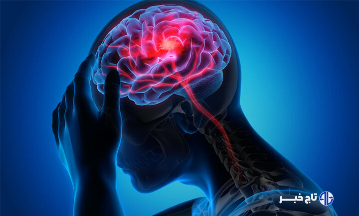 مراجعه سریع به بیمارستان کلید درمان مؤثر سکته مغزی است