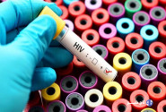 هشدار سازمان جهانی بهداشت نسبت به افزایش موارد ابتلا به HIV در فیلیپین
