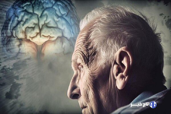 آلزایمر همیشه ارثی نیست!