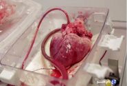 انتقال قلب برای پیوند به نوجوان ۱۵ ساله با اورژانس هوایی