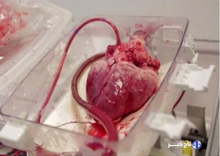 انتقال قلب برای پیوند به نوجوان ۱۵ ساله با اورژانس هوایی