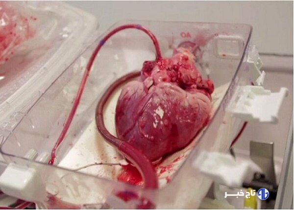 انتقال قلب برای پیوند به نوجوان ۱۵ ساله با اورژانس هوایی